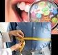 میکروب های دهان می‌توانند کلید پیشگیری از چاقی باشند