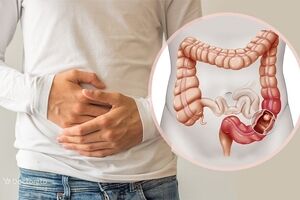 آیا نگه داشتن مدفوع، مضر است؟ 