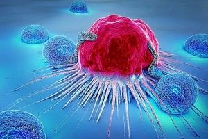 در ایران بین ۳۰ تا ۴۰ دقیقه، یک زن به سرطان سینه مبتلا می‌شود/ هر سال ۲۰ هزار بیمار جدید داریم 