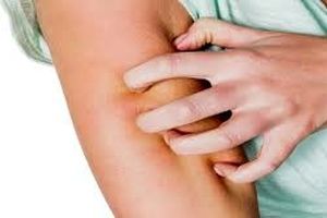 یک علامت پنهان مشکلات کبدی