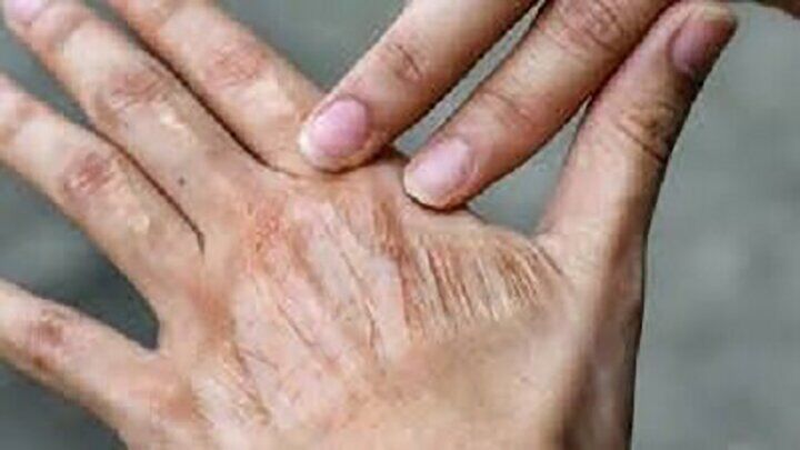 اقدام ساده برای رفع خشکی پوست