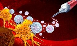 گام‌های اولیه توسعه واکسن mRNA برای مقابله با سرطان پستان در کشور