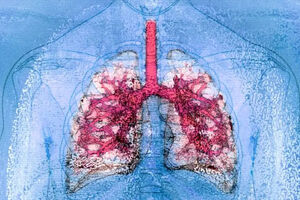 نخستین پیوند همزمان ریه و کبد میان دو فرد HIV مثبت 