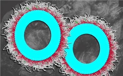 نابودی بیش از ۸۰ درصدی تومورهای تخمدان با نانوذرات جدید