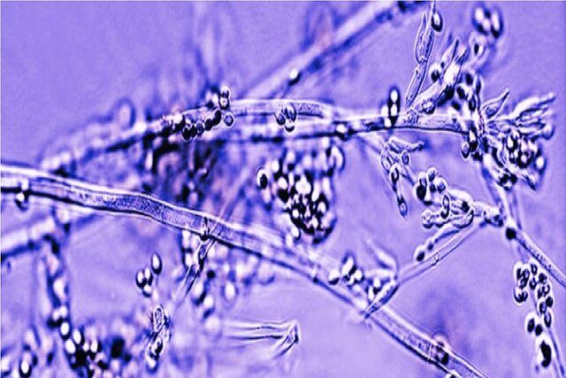 بانداژهای ساخته شده از قارچ‌های زنده؛ آینده‌ التیام زخم