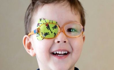 ضرورت درمان تنبلی چشم پیش از ۱۰ سالگی