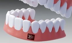 تشخیص التهاب لثه فقط با یک برچسب