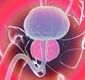 چرا پروستات با افزایش سن بزرگ می‌شود؟