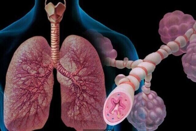 توصیه حیاتی به مبتلایان آسم؛ شهریور این واکسن را تزریق کنید