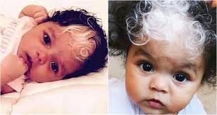 علت سفید شدن موی کودک و نکات ضروری برای والدین