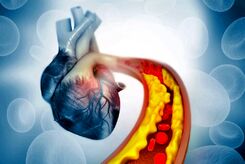 کاهش چربی خون با کمک ویرایش ژن برای اولین بار