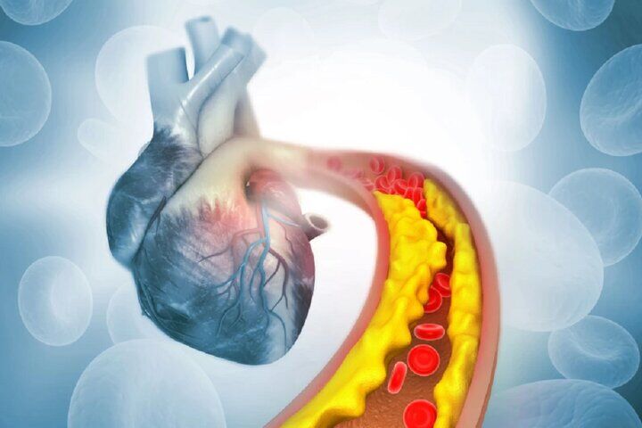 کاهش چربی خون با کمک ویرایش ژن برای اولین بار