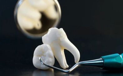 دندان‌ انسان برای اولین بار در آزمایشگاه رشد داده شد