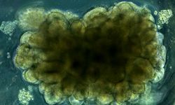 دانشمندان «مینی‌مغز» ساختند و به آن حل مسئله یاد دادند 