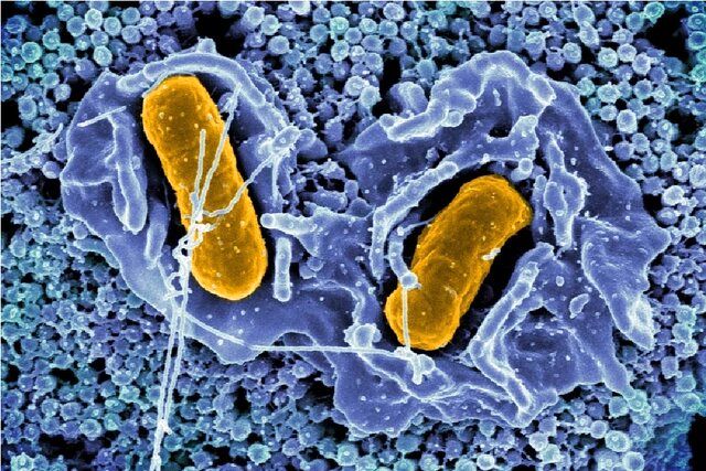 مهندسی «سالمونلا» برای هدف قرار دادن تومور سرطان روده بزرگ