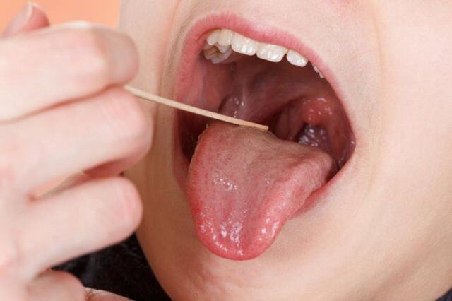 نقش لوزه‌ها در سیستم ایمنی بدن