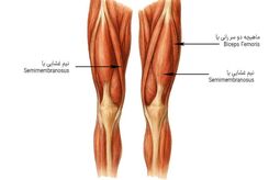 علت کوتاهی عضلات چیست؟