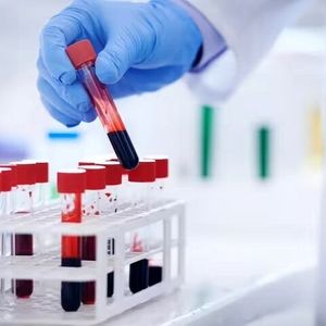 تشخیص خستگی مزمن با یک آزمایش خون پیشرفته
