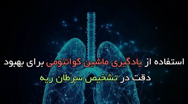 استفاده از یادگیری ماشین کوانتومی برای بهبود دقت در تشخیص سرطان ریه