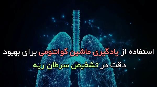 استفاده از یادگیری ماشین کوانتومی برای بهبود دقت در تشخیص سرطان ریه