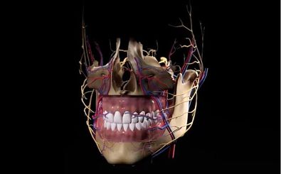 موفقیت جراحان کشور در عمل جمجمه بیمار تصادفی با ایمپلنت ایرانی جاذب استخوان