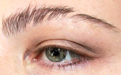 کمبود کدام ویتامین ها باعث ریزش ابرو می شوند؟ 