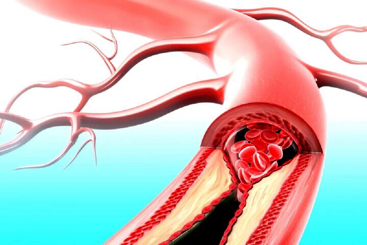 دارویی که همزمان با بیماری قلبی و دیابت مقابله می‌کند