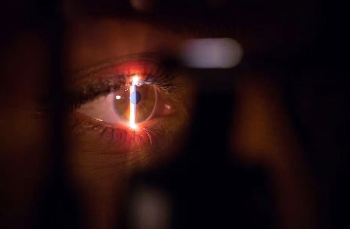 پیش‌بینی خطر نابینایی توسط ‎هوش مصنوعی