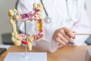 نتایج یک پژوهش جدید؛ افراد مبتلا به سرطان روده چگونه می‌توانند مانند افراد عادی عمر کنند؟